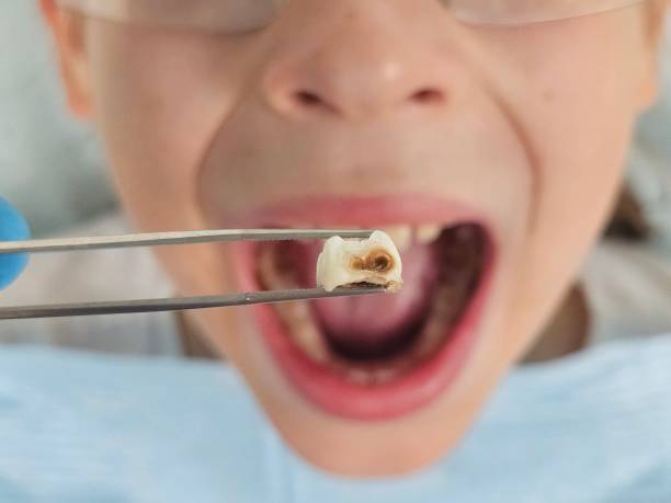 Best Pediatric Emergency Dentist in Ida Grove, IA