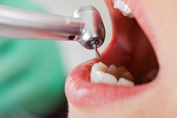 Best Emergency Treatment for Dental Infections or Abscesses in Ida Grove, IA